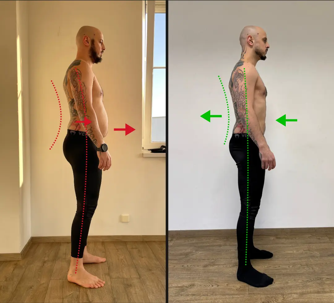 Before and after: back and groin pain eliminated, posture corrected